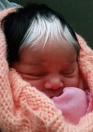 Ce Bebe Aux Cheveux Blancs Herite De Sa Mere Fait Le Buzz