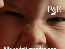 Elle se fait mordre par son fils de 6 ans-min