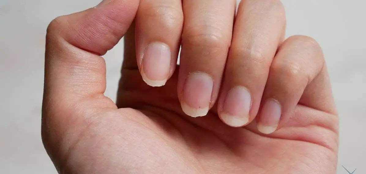 ongle-min