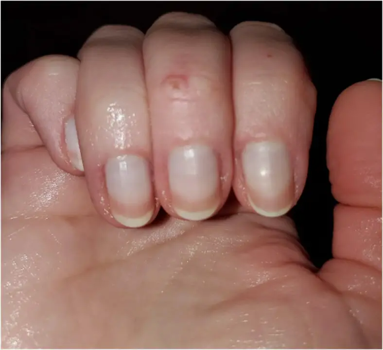 ongles terry