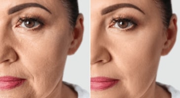 un effet lissant