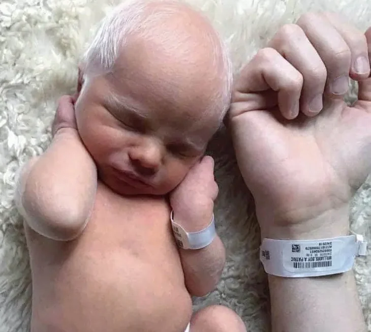 bébé different et alors