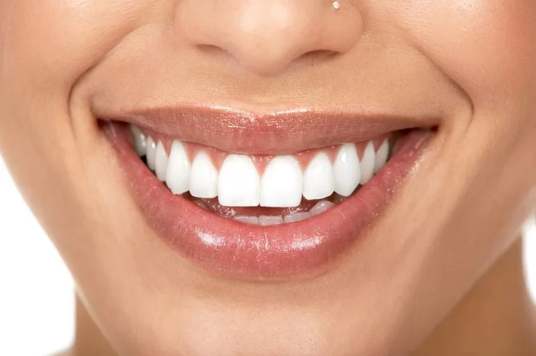 un sourire blanc